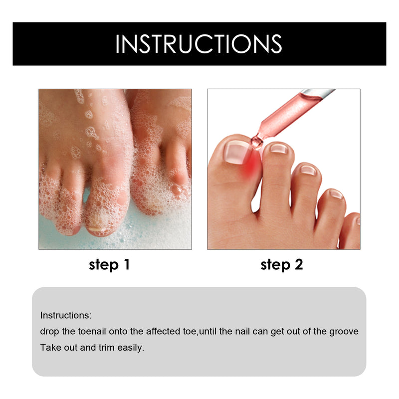 South Moon Toenail Repair Serum 30ml Moisturizing Repair Cleansing Foot Nail Brightening Nail Care Oil