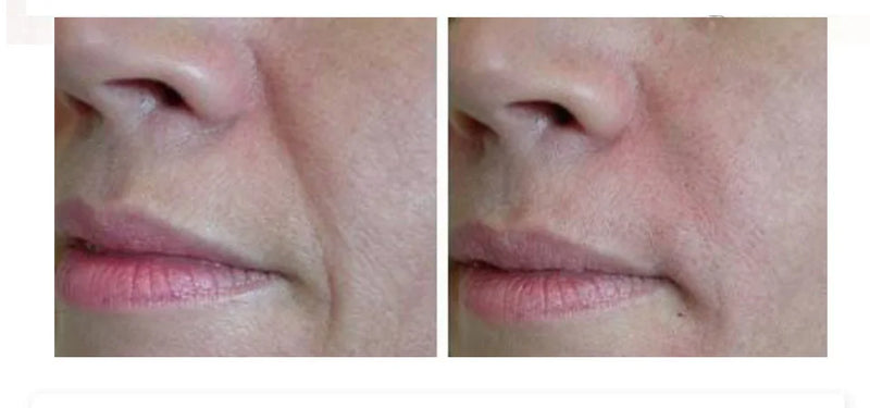White Rice Face Serum Shrink Pores Brightening Whitening Cream Anti Aging Lines and Wrinkles for Glowing Skin Firm Care Essence