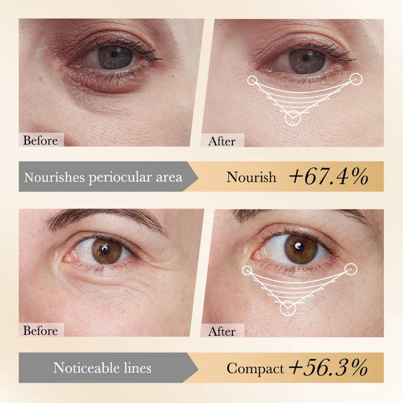 1-10pcs Crystal Collagen Eye Mask Anti Dark Circles Remove Eyes Bags Moisturizing Eyes Patches Gel Masks Skin Care