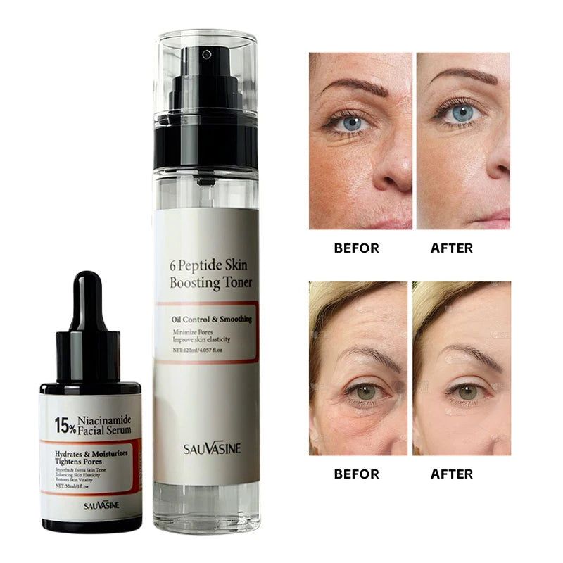150ml Niacinamide 15% Peptide Booster Set 120ml 6peptide Skin Toner30ml 15% Facial Serum Korean Whiten Moisturizing Facial Care