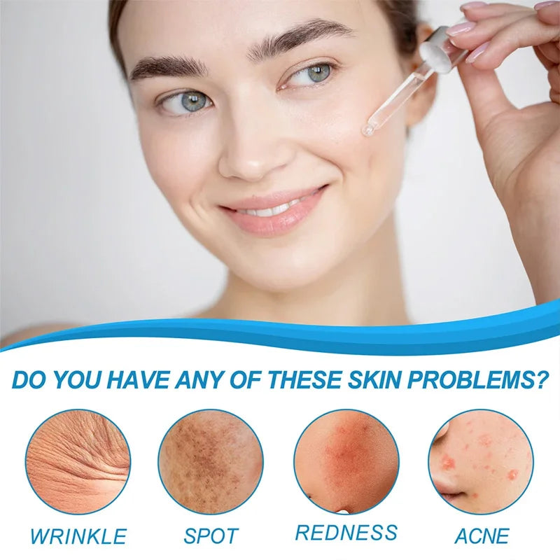 B5 Hyaluronic Acid Serum Facial Anti Aging Wrinkle Lift Firming Fine Lines Lightening Dark Circle Skin Brightening Hyalu Serum