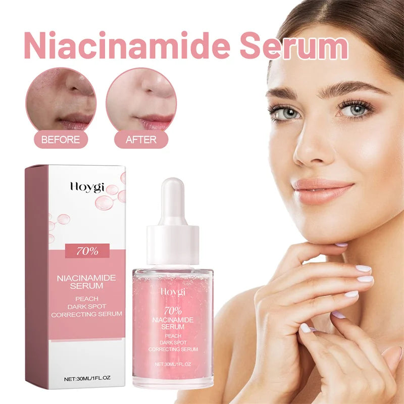 Niacinamide Whitening Facial Essence Remove Acne Marks Dark Spots Moisturizing Repair Shrink Pores Brighten Face Skin Care Serum