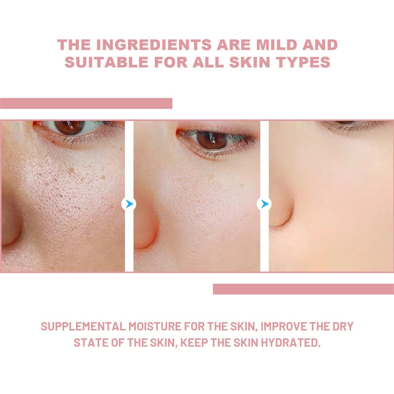 Niacinamide Whitening Facial Essence Remove Acne Marks Dark Spots Moisturizing Repair Shrink Pores Brighten Face Skin Care Serum