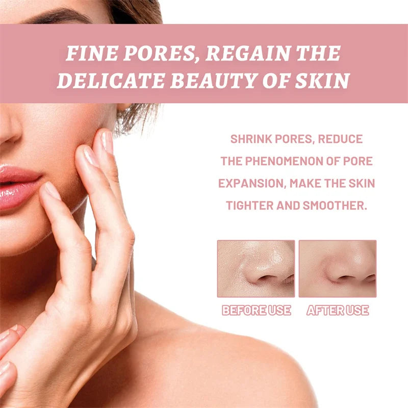 Niacinamide Whitening Facial Essence Remove Acne Marks Dark Spots Moisturizing Repair Shrink Pores Brighten Face Skin Care Serum