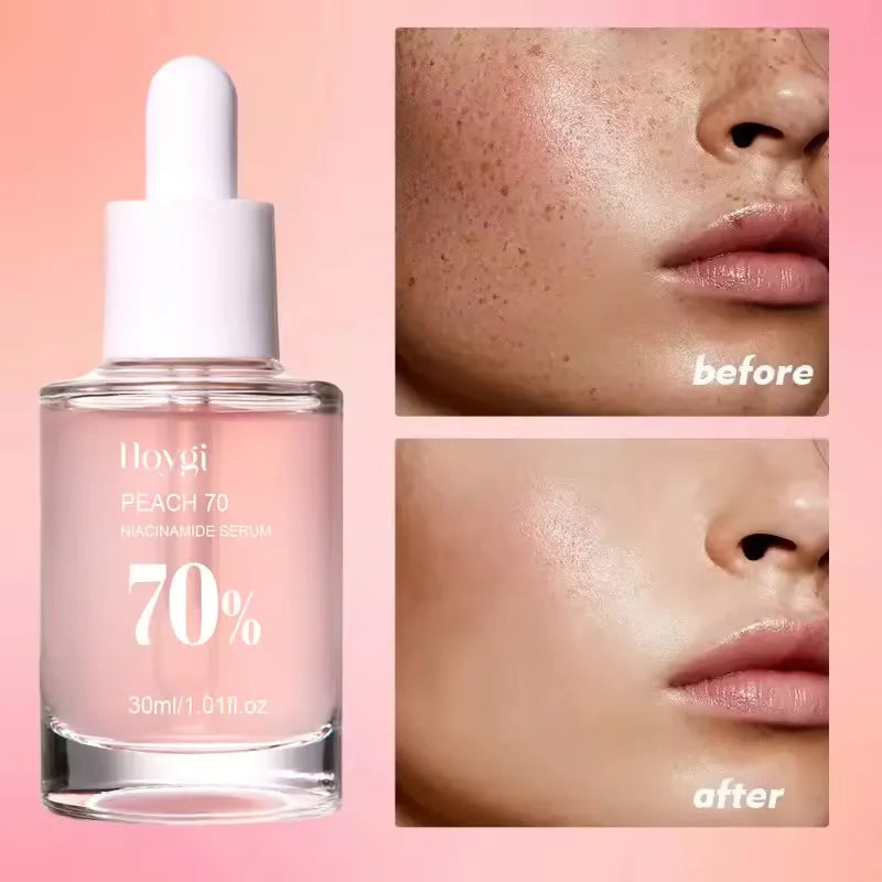 Niacinamide Whitening Facial Essence Remove Acne Marks Dark Spots Moisturizing Repair Shrink Pores Brighten Face Skin Care Serum
