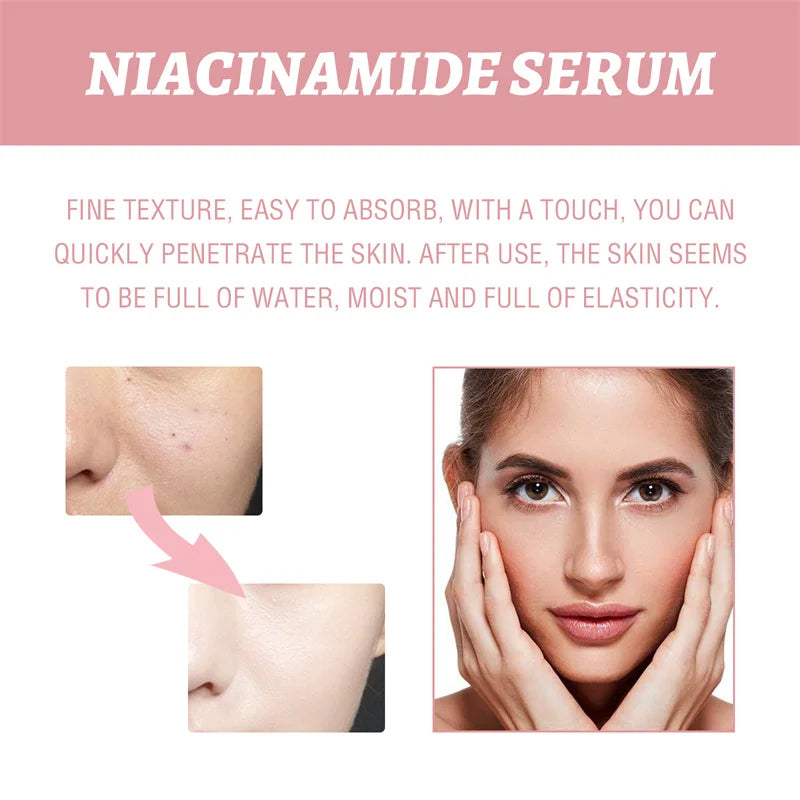 Niacinamide Whitening Facial Essence Remove Acne Marks Dark Spots Moisturizing Repair Shrink Pores Brighten Face Skin Care Serum