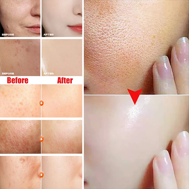 Niacinamide Whitening Facial Essence Remove Acne Marks Dark Spots Moisturizing Repair Shrink Pores Brighten Face Skin Care Serum