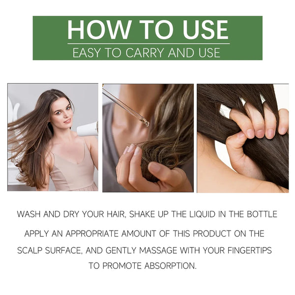 YOUNGCOME Rosemary hair care essential oil,Nourishes Repairs Improves Frizz Prevents Hair Loss Thinning Damaged Hair Care