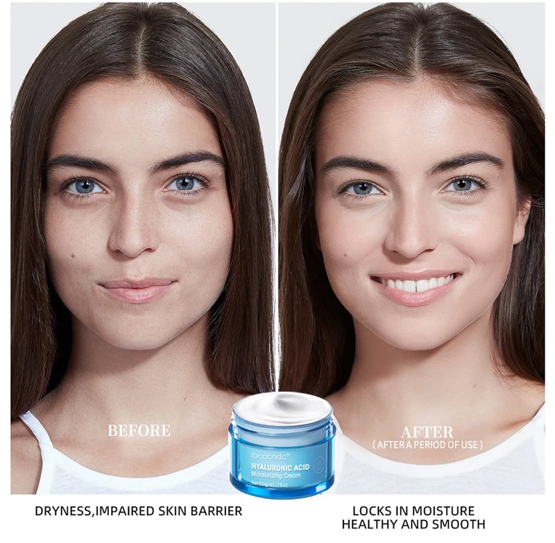 Hyaluronic Acid Gel Cream Hydrating Face Moisturizer For Hydrate&Smooth Extra-Dry Skin Nourishing Improve Dryness Facial Lotion