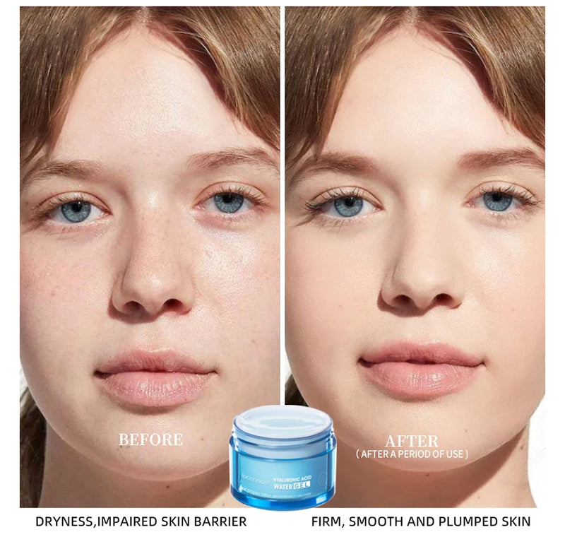 Hyaluronic Acid Gel Cream Hydrating Face Moisturizer For Hydrate&Smooth Extra-Dry Skin Nourishing Improve Dryness Facial Lotion
