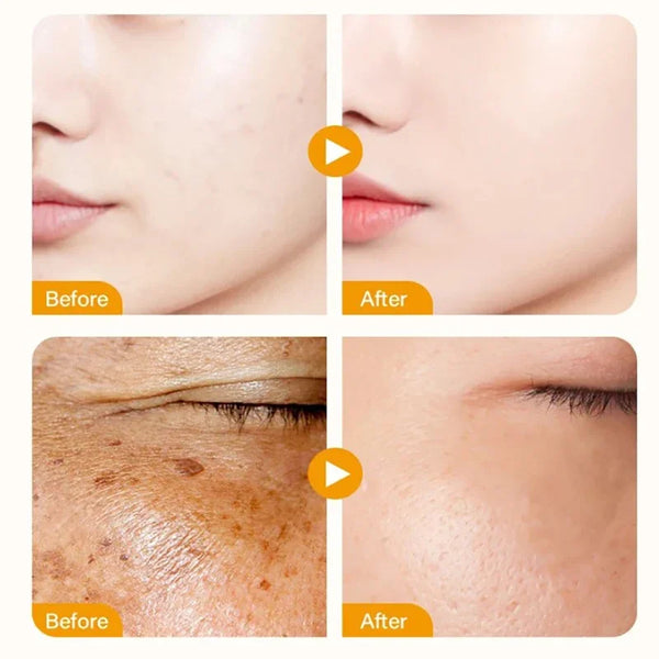 4IN1 Facial Serum Hyaluronic Acid Niacinamide VC VE Serum Cosmetics Dark Spot Remover Hydrating Moisturize Beauty Whiten Makeup