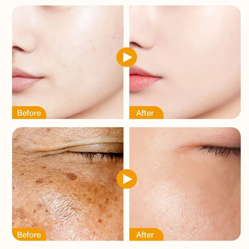 4IN1 Facial Serum Hyaluronic Acid Niacinamide VC VE Serum Cosmetics Dark Spot Remover Hydrating Moisturize Beauty Whiten Makeup