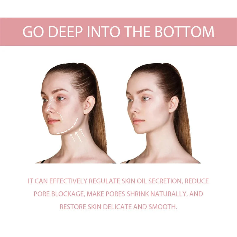 Niacinamide Whitening Facial Essence Remove Acne Marks Dark Spots Moisturizing Repair Shrink Pores Brighten Face Skin Care Serum